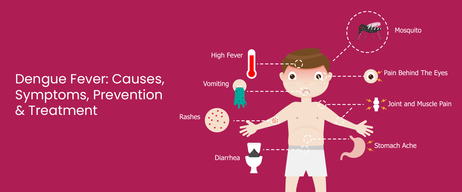 dengue fever symptoms and treatment