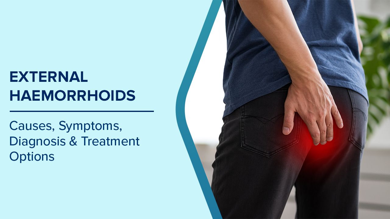 Piles (Hemorrhoids)
