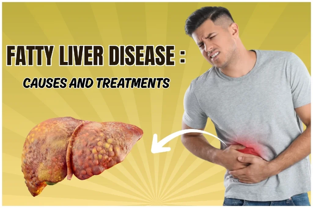 fatty liver