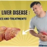 fatty liver