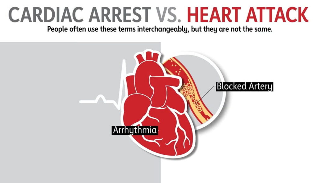 Heart Attack