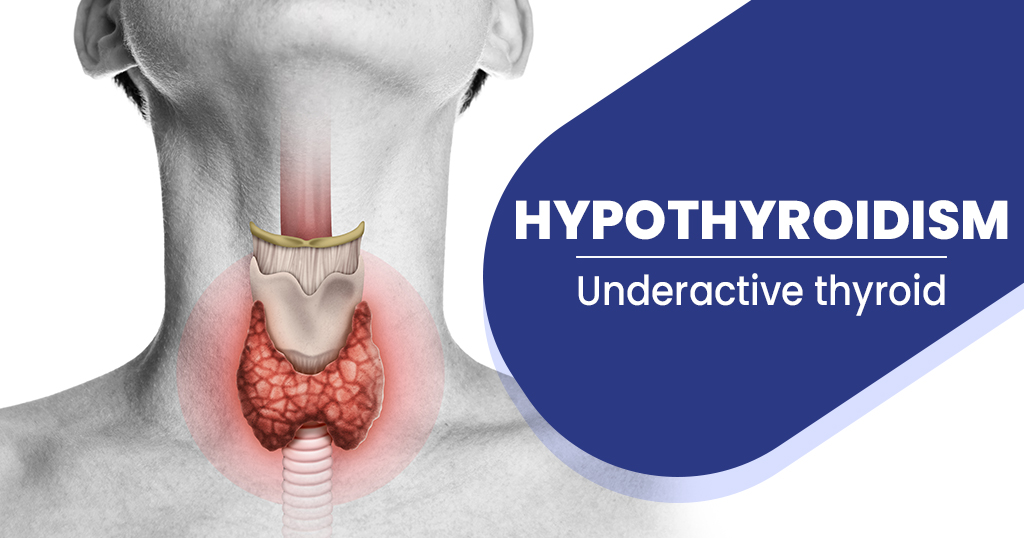 Hypothyroidism Symptoms and Causes