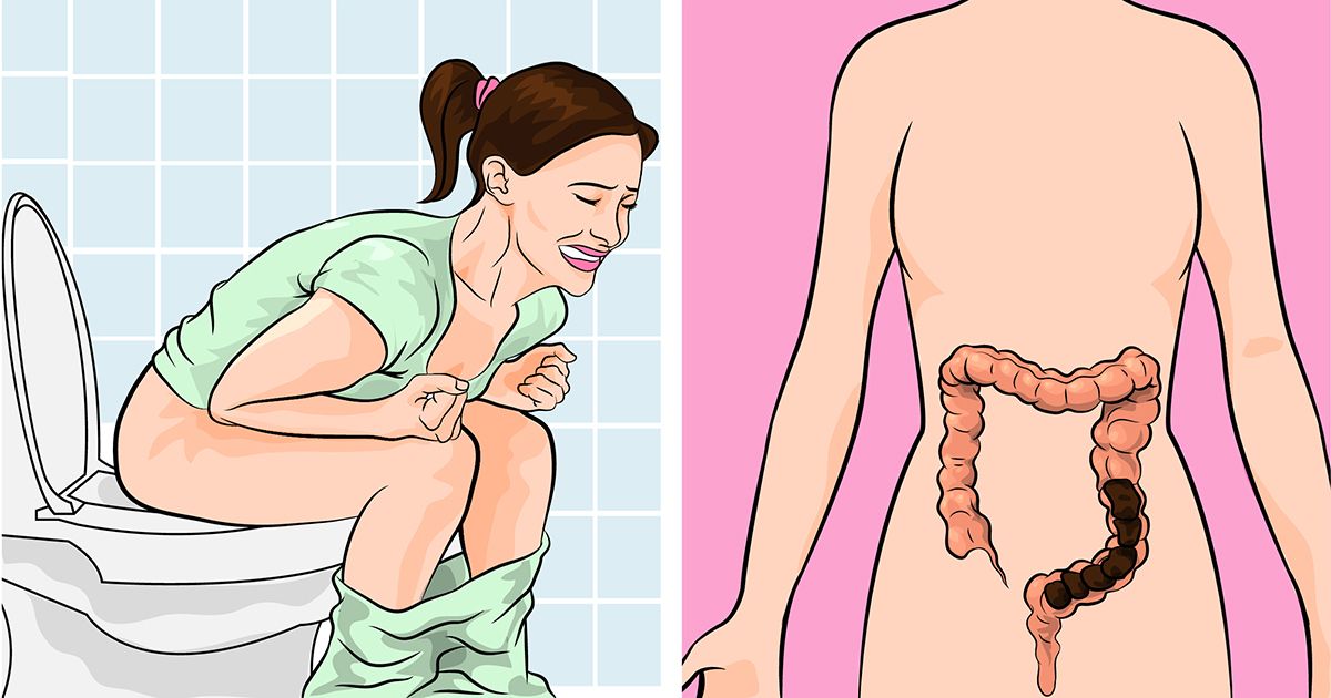 natural remedies for constipation