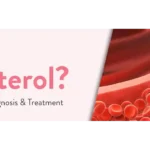 Natural Ways to Lower Cholesterol