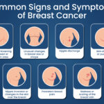 breast cancer symptoms and causes