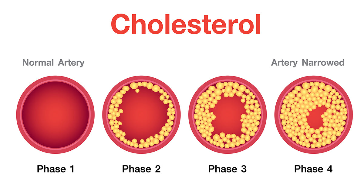 Natural Ways to Lower Cholesterol