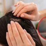 homemade oil for hair fall