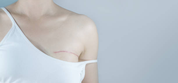 Breast Cancer Symptoms and Causes: What You Need to Know