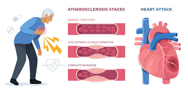 Heart Attack Warning Signs You Should Never Ignore