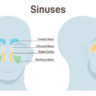 Sinus (Sinusitis): Causes, Symptoms & Treatment, Home Remedies