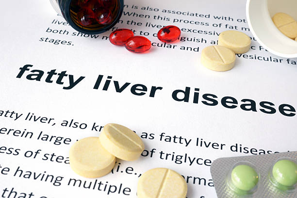 Fatty Liver: Causes, Symptoms, and Treatment, Home Remedies