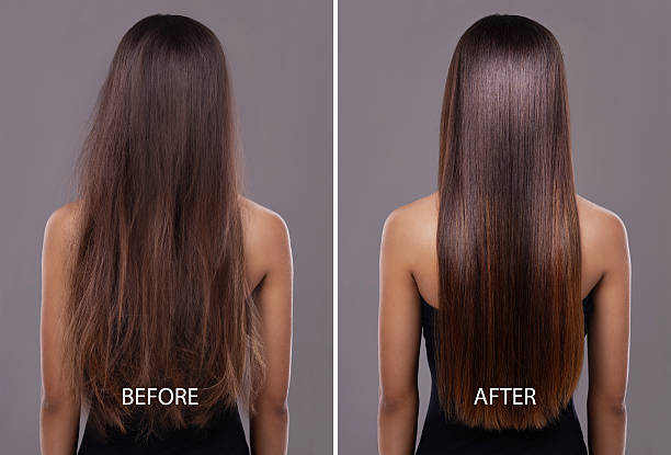 Discover the 10 Best Shampoos for Hair Fall: Expert Recommendations