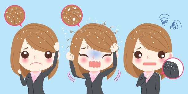 Home Remedies for Itchy Scalp