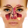 sinusitis