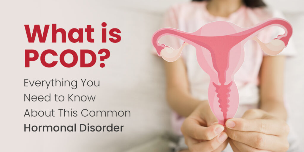PCOD problem in women