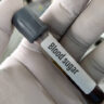 Easy Ways to Lower Blood Sugar Levels Naturally