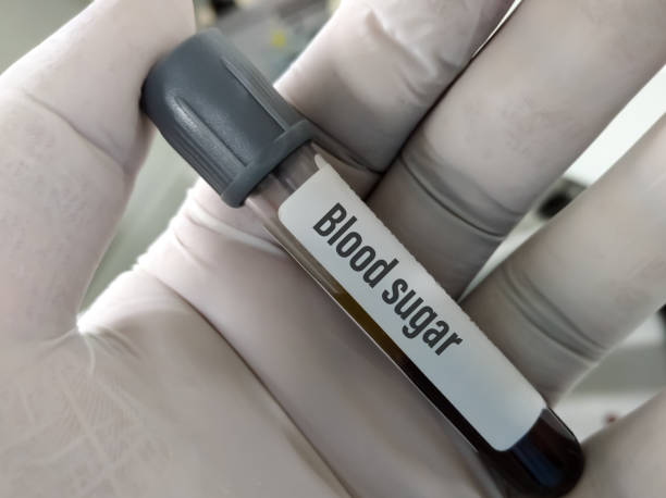 Easy Ways to Lower Blood Sugar Levels Naturally