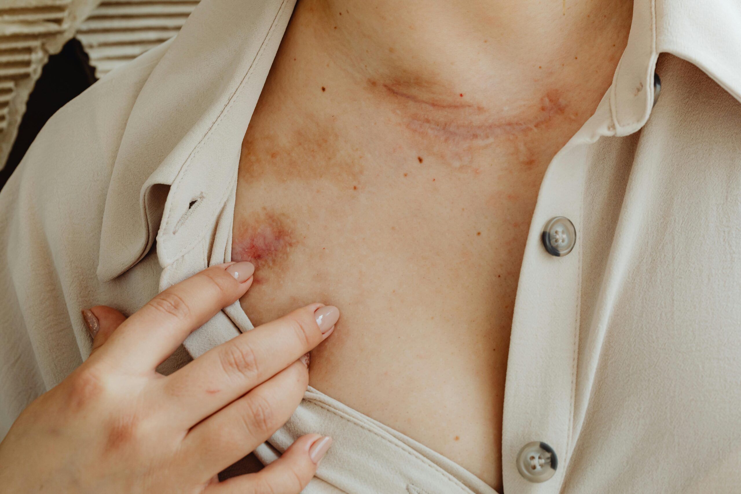 allergy treatment options