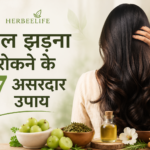 बाल झड़ना रोकने के उपाय